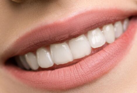 Las cinco alternativas naturales para que tus dientes dejen de estar amarillos