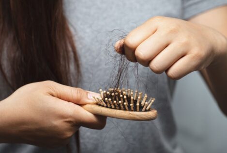 ¿Cuál es la vitamina que evita la alopecia?