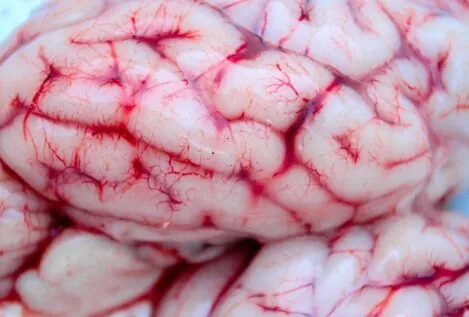 Los ocho alimentos que dañan a tu cerebro y los comes cada día