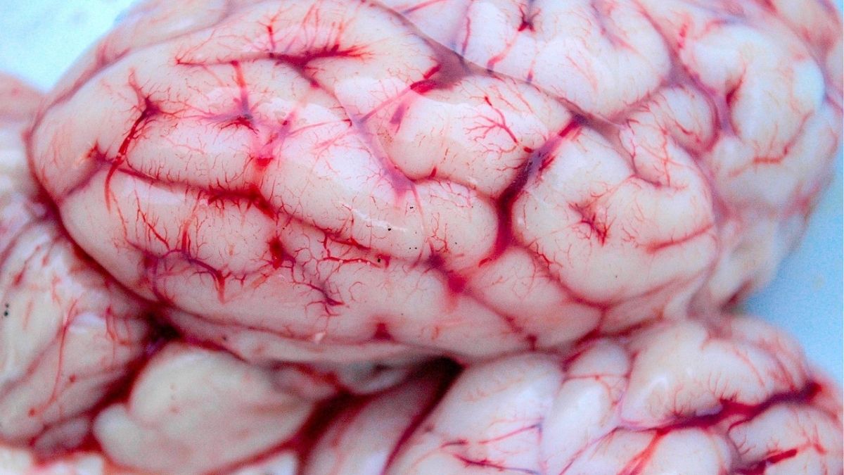 Los ocho alimentos que dañan a tu cerebro y los comes cada día