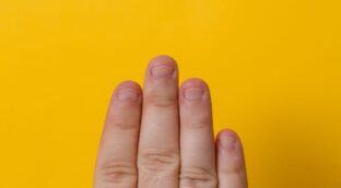 La gravedad de morderse las uñas: la bacteria que podría llevarte a una operación de corazón