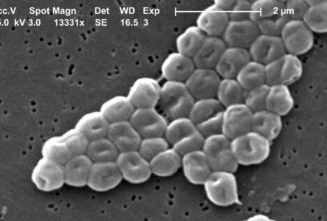La batalla entre dos virus en una bacteria abre nuevas vías contra la resistencia a antibióticos