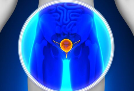 Nueva terapia para combatir el cáncer de vejiga