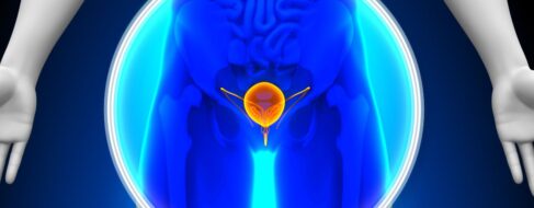 Nueva terapia para combatir el cáncer de vejiga