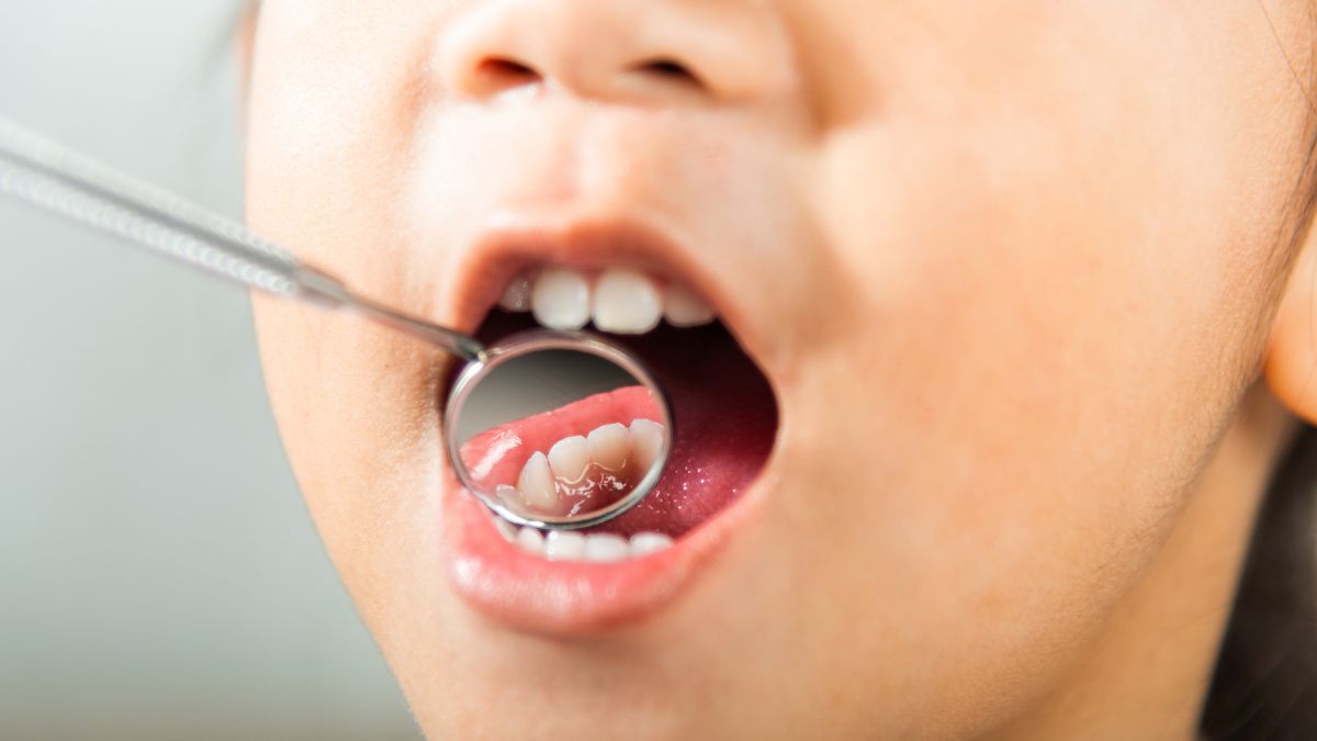 La bebida que está de moda en bebés y está produciendo caries