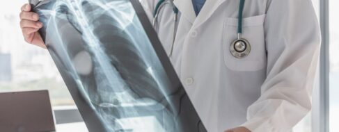 La ciencia revela la causa del cáncer óseo agresivo y potencia nuevos tratamientos