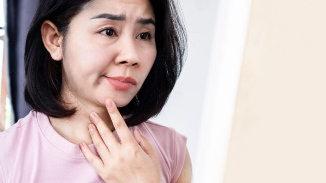 ¿Cuáles son los primeros síntomas de la parálisis facial por estrés?