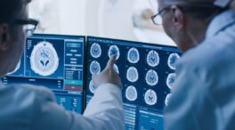 La vida después del ictus: claves para una recuperación plena