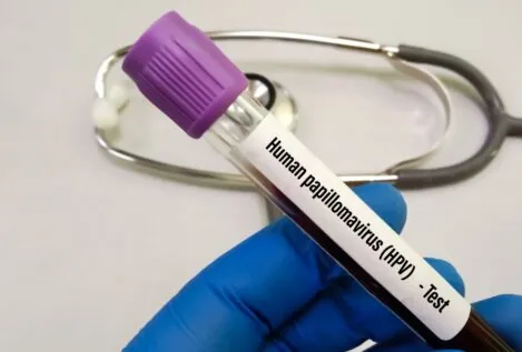 Un estudio refuerza la relación del virus del papiloma humano con enfermedades cardíacas
