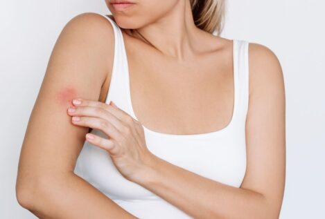 Novartis lanza una campaña para visibilizar la Hidradenitis Supurativa