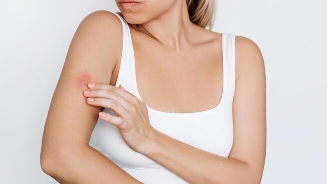 Novartis lanza una campaña para visibilizar la Hidradenitis Supurativa