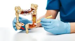 Los siete síntomas del cáncer de colon en mujeres