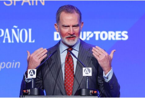 El Rey impacta con la cara quemada tras su fin de semana de esquí: «Pasa por no protegerse»