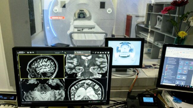 Mi cerebro y yo: así colaboro en un proyecto de detección temprana del Alzhéimer