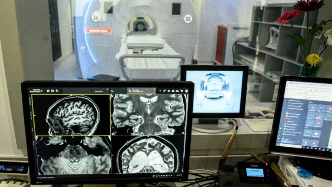 Mi cerebro y yo: así colaboro en un proyecto de detección temprana del Alzhéimer