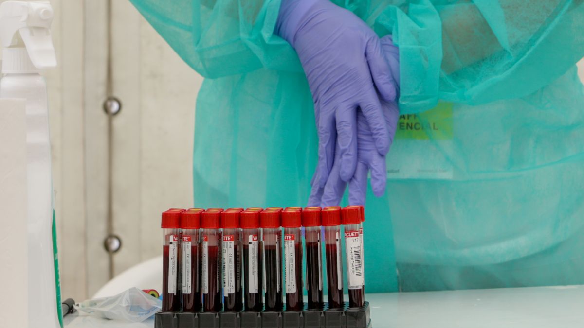 Los sistemas de información de Sanidad no estaban preparados para la pandemia de covid