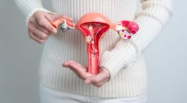 La estrecha relación entre la endometriosis y la vitamina D