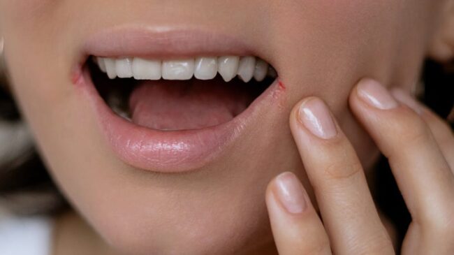 La misteriosa relación entre los herpes y el alzhéimer