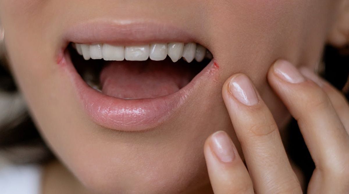 La misteriosa relación entre los herpes y el alzhéimer