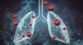 ​Silicosis: qué es y por qué afecta a trabajadores expuestos a sílice​