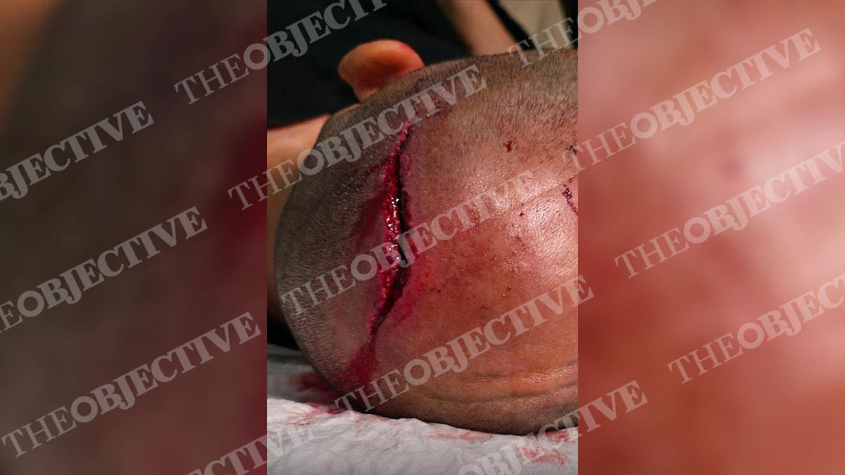 Violencia contra los Mossos en Lérida: «Nos han intentado matar»