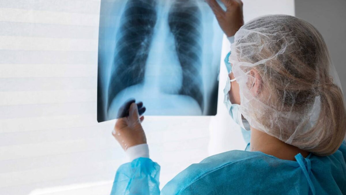 Identifican una nueva diana terapéutica para el cáncer de pulmón