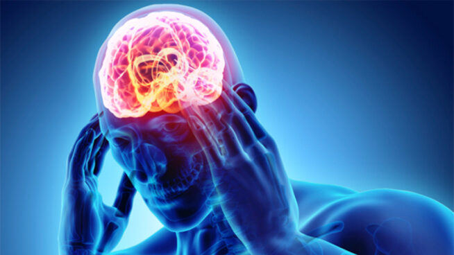 Conocer los síntomas de la epilepsia puede ayudar a prevenir el desencadenamiento de una crisis