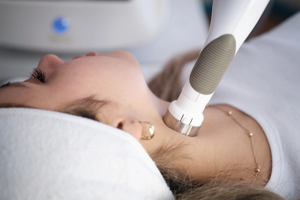 Uso de radiofrecuencia en el cuello. (Fuente: Clínica Fit)