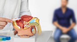Hiperplasia benigna de próstata: qué es y por qué se inflama