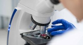 La falta de una proteína inicia el cáncer de colon en ratones