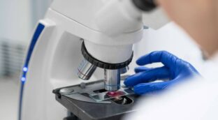 La falta de una proteína inicia el cáncer de colon en ratones