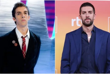 La verdad sobre los retoques de Broncano: una médico estética analiza la evolución de su rostro