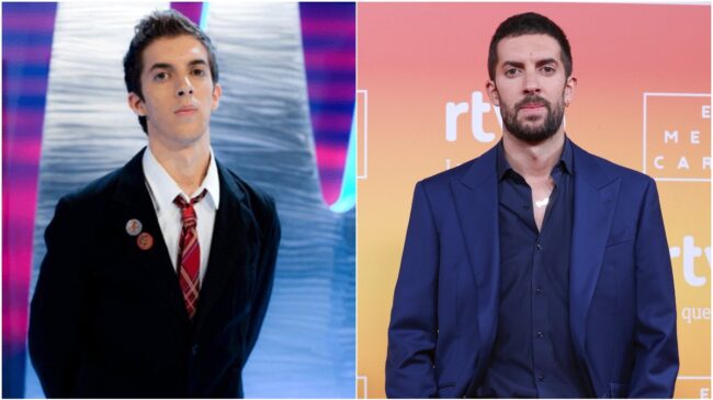 La verdad sobre los retoques de Broncano: una médico estética analiza la evolución de su rostro