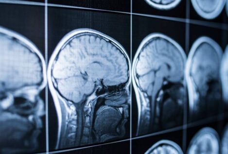 Por qué el cerebro convierte estímulos breves en emociones duraderas