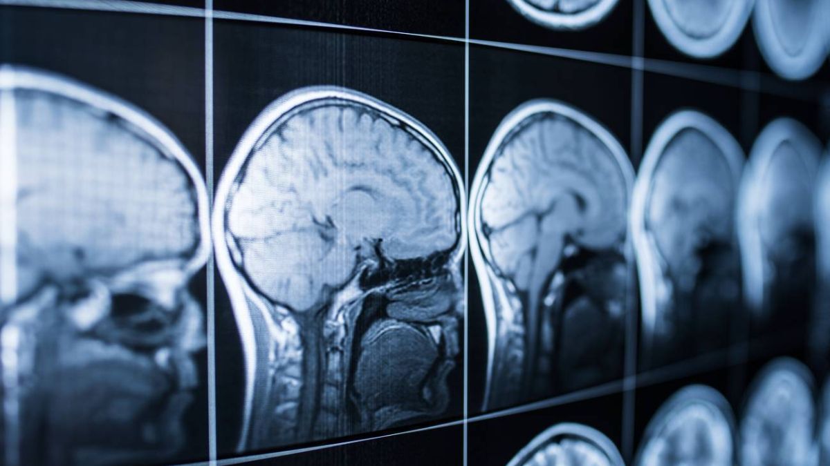 Por qué el cerebro convierte estímulos breves en emociones duraderas
