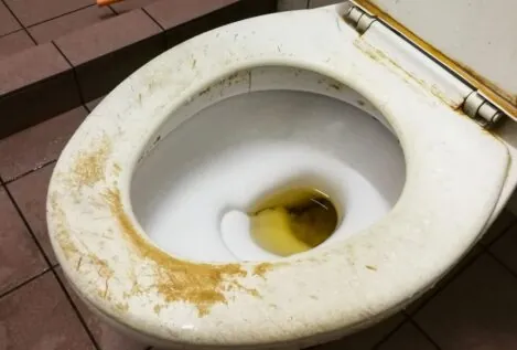 Papel de cocina y vinagre: el truco de una experta para limpiar a fondo el inodoro