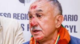 Pepe Álvarez reaparece con la cara llena de heridas en el Congreso de UGT de Segovia