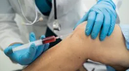 Elvira Iglesias, traumatóloga: «Si la rodilla falla tras operarte, puedes sufrir artrosis precoz»