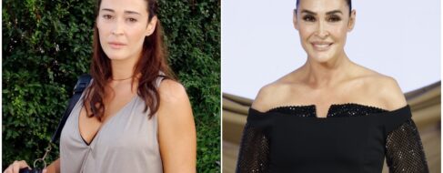 El antes y el después de Vicky Martín Berrocal: una médico estética analiza todos sus retoques