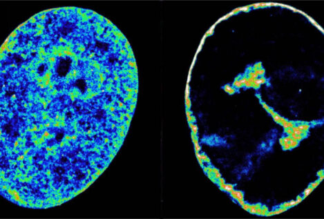 Así reorganiza el herpes labial el genoma humano para propagarse