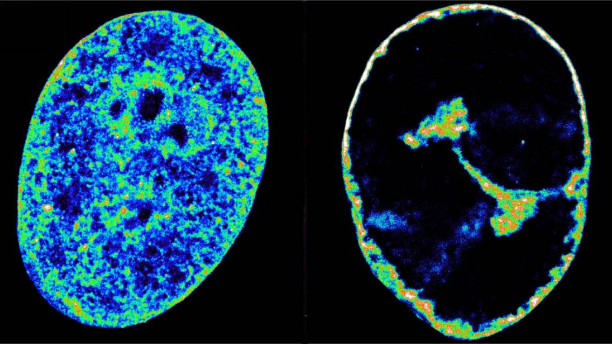 Así reorganiza el herpes labial el genoma humano para propagarse