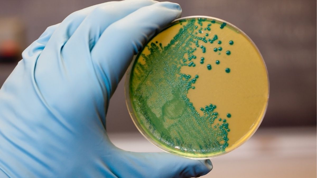 Las infecciones por Escherichia coli y Listeria alcanzan máximos históricos en la UE