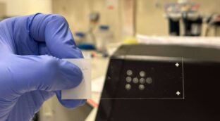 Una técnica permite analizar millones de células individuales sin necesidad de secuenciarlas