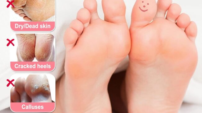 Calcetines exfoliantes para pies: el secreto para tener pies suaves sin salir de casa