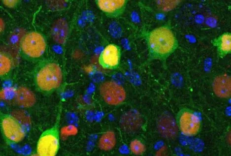 Descubren qué neuronas están implicadas en la ansiedad y el aislamiento social