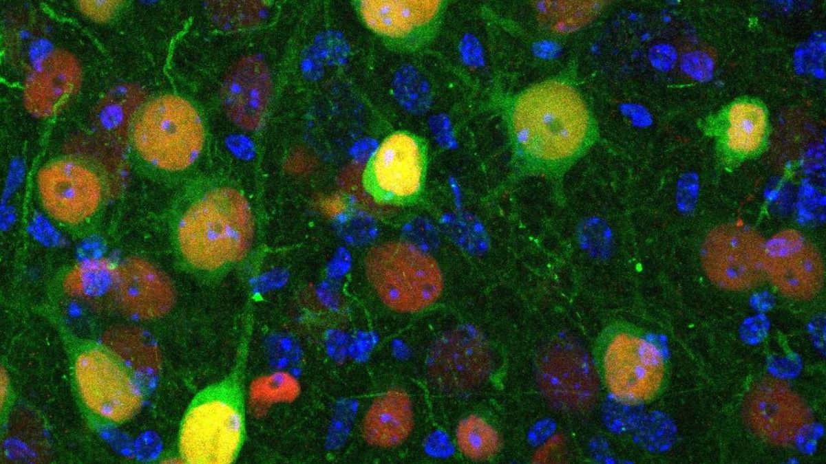 Descubren qué neuronas están implicadas en la ansiedad y el aislamiento social