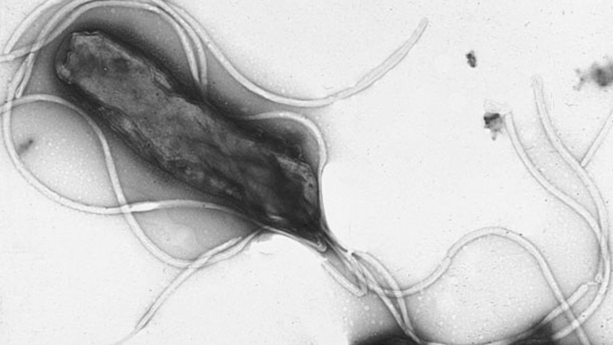 La ‘Helicobacter pylori’ podría causar casi 12 millones de casos de cáncer de estómago