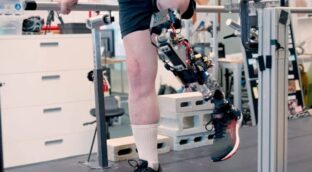 Una rodilla biónica integrada en el tejido devuelve la movilidad tras una amputación