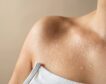 Sudoración excesiva más allá del calor: qué es la hiperhidrosis y cómo se trata y controla