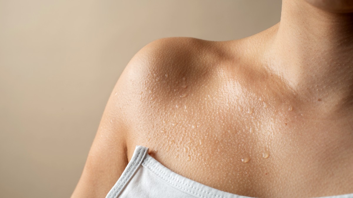 Sudoración excesiva más allá del calor: qué es la hiperhidrosis y cómo se trata y controla